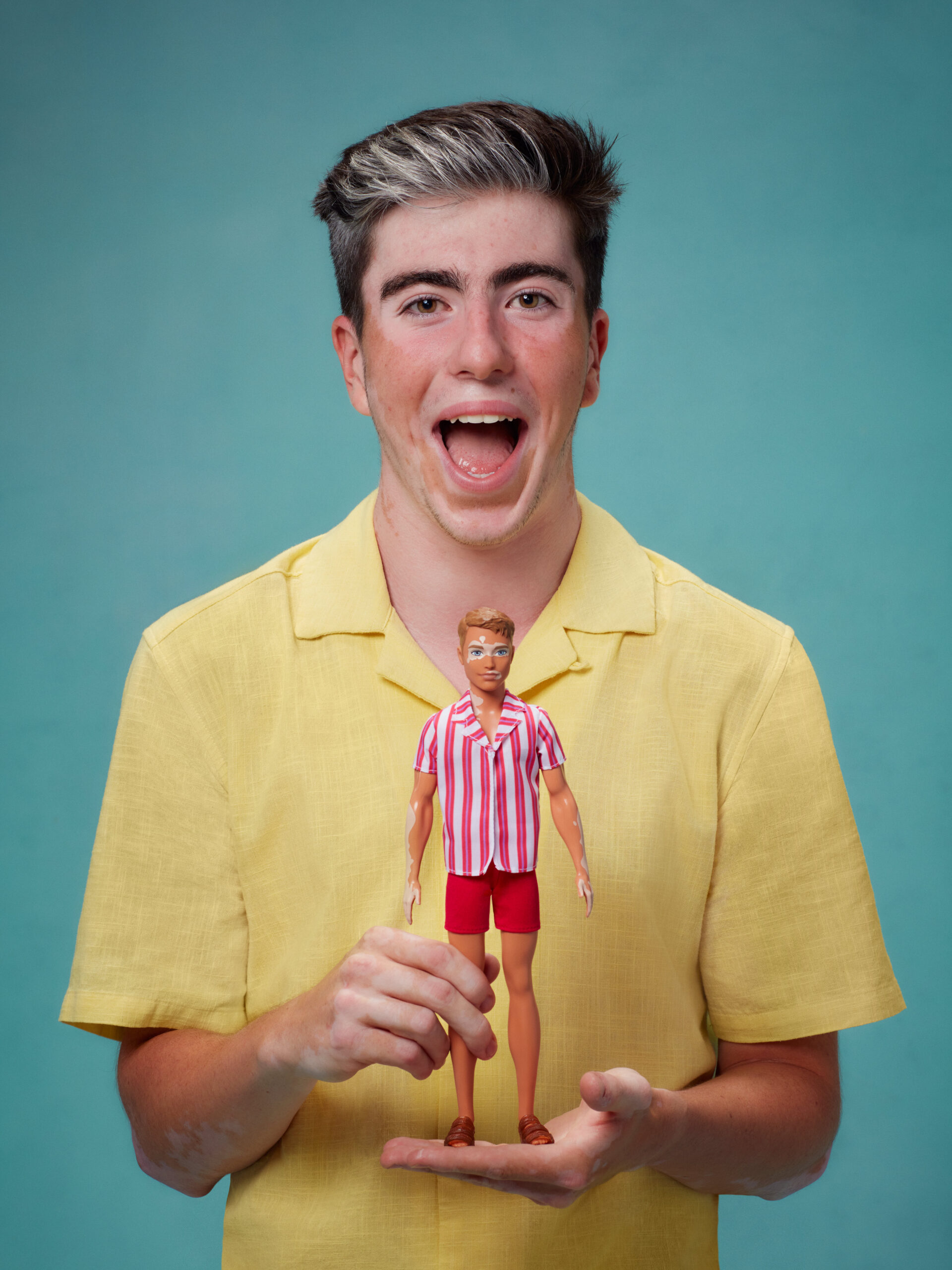 Model beams with Ken Doll who has vitiligo