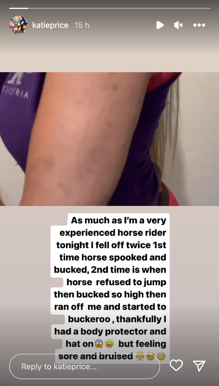 Katie Price's bruised arm on her Instagram story