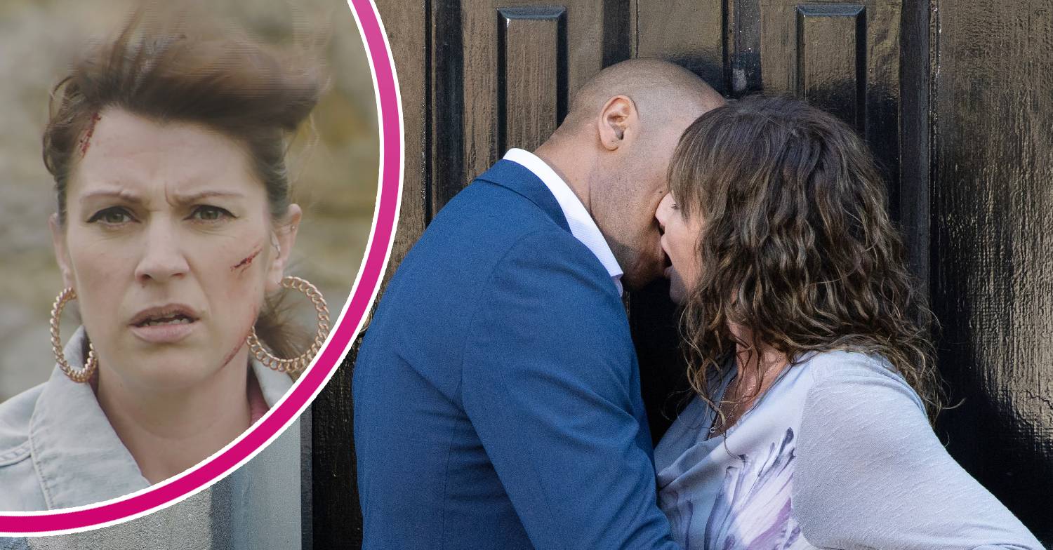 Emmerdale Kerry looking shocked with a cut on her face and Al and Chas kissing