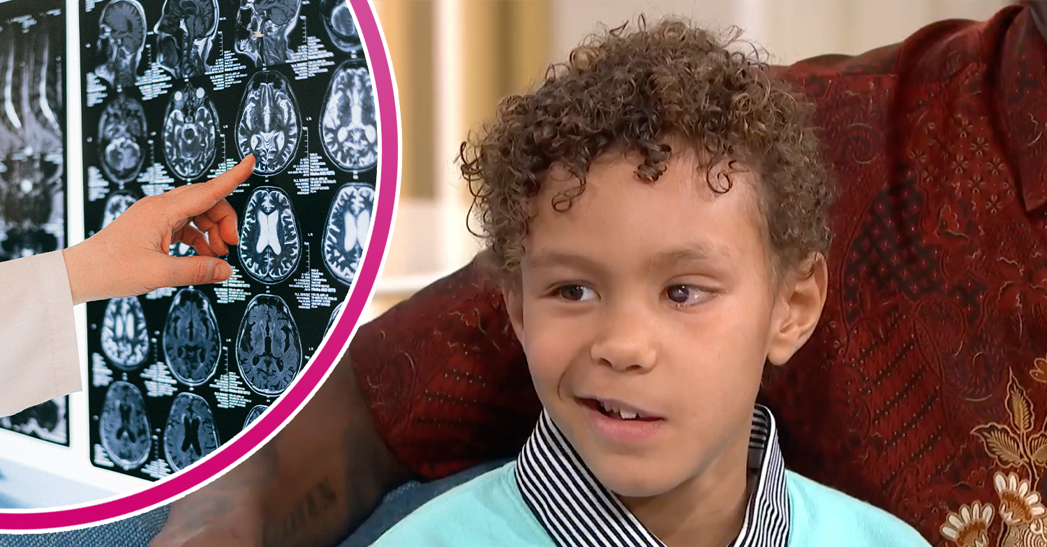 A brain scan and Ravi displaying his symptoms