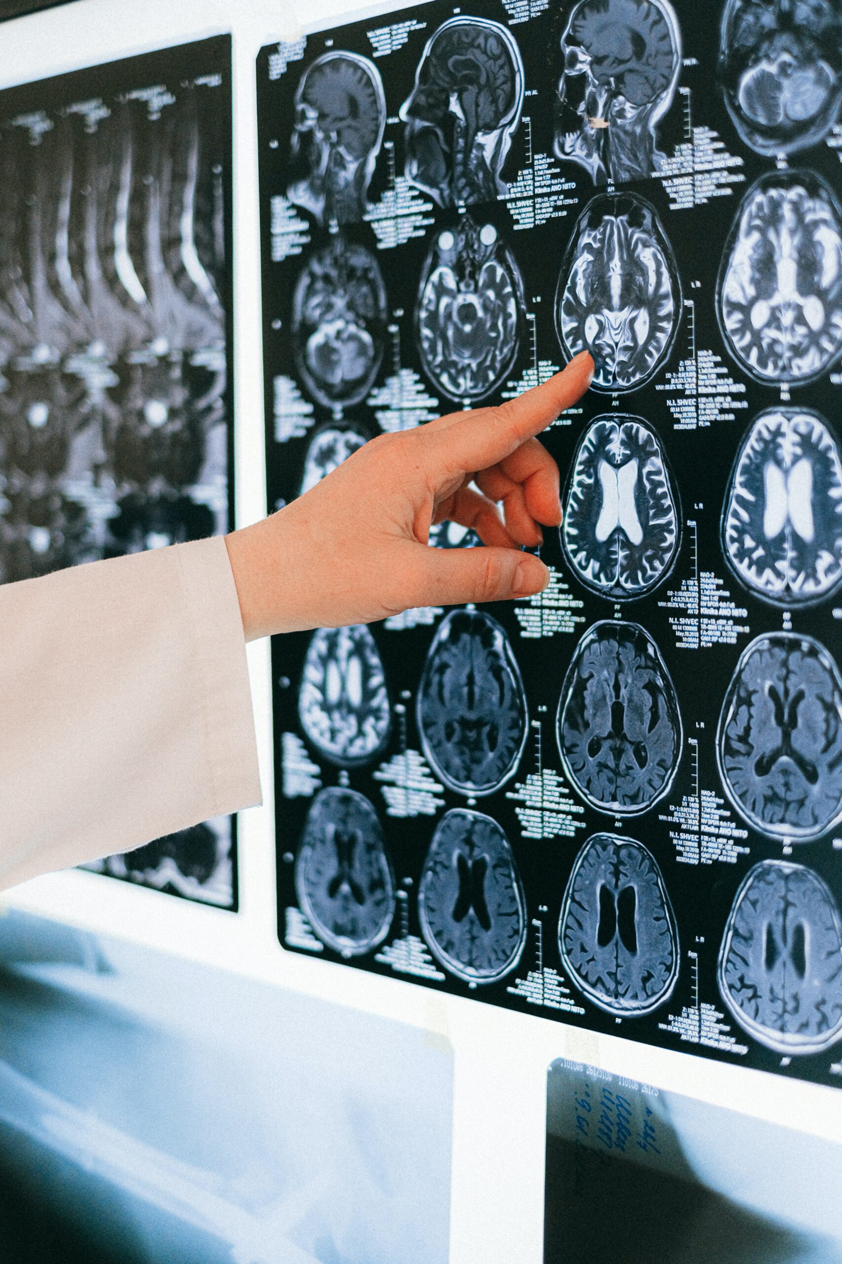 A doctor pointing at a brain scan