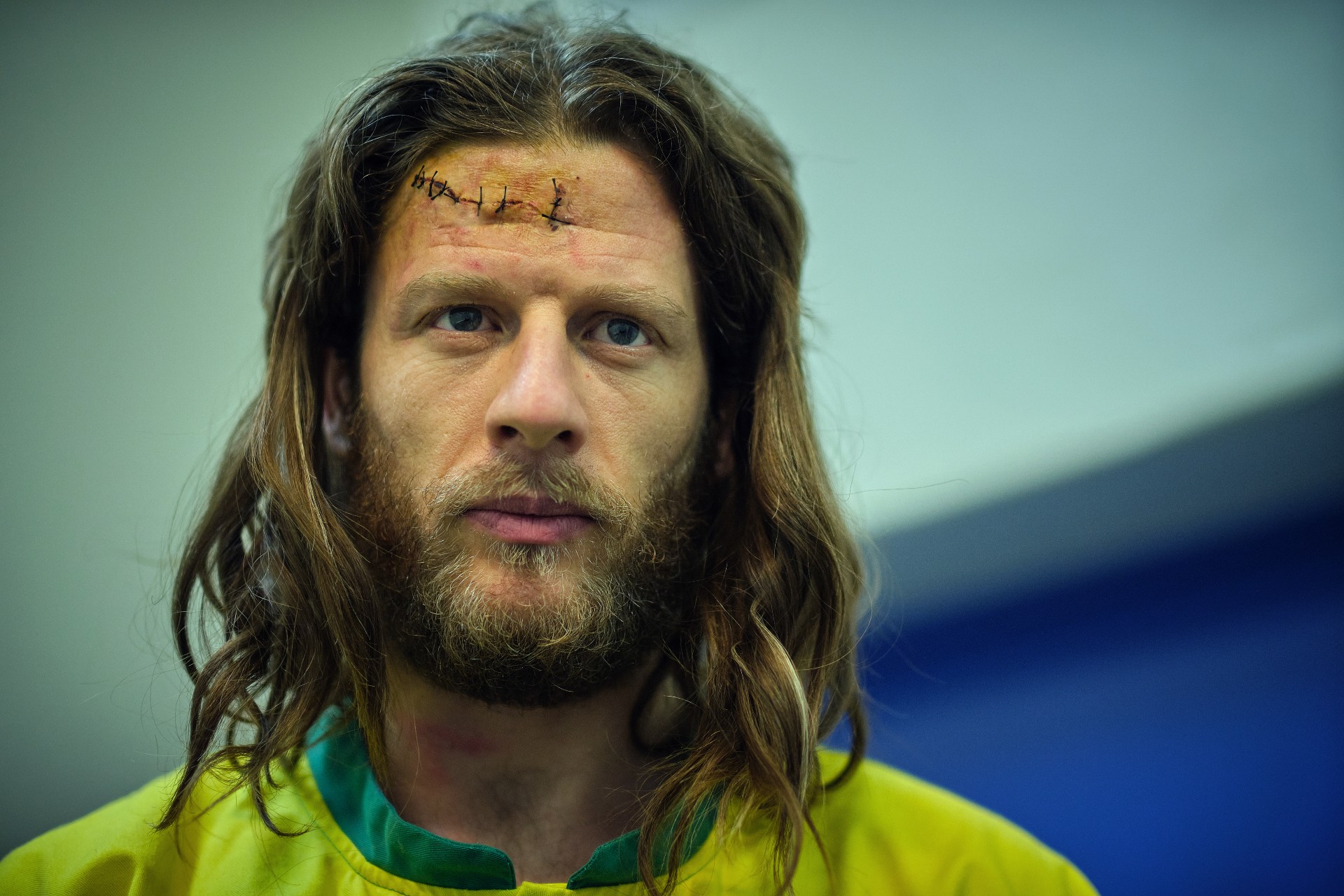 James Norton with huge scar and long hair
