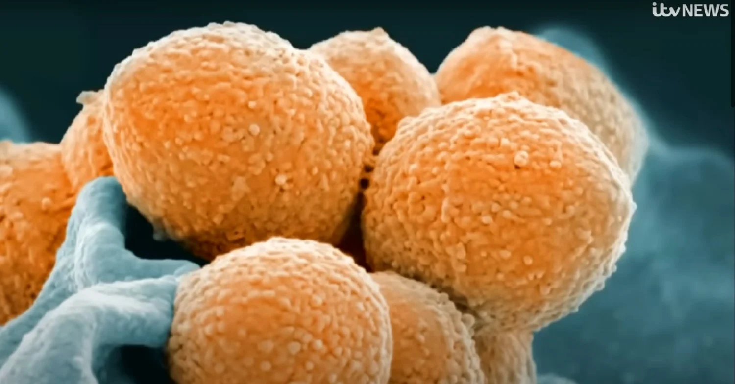 Zoomed in image of Strep A bacteria 