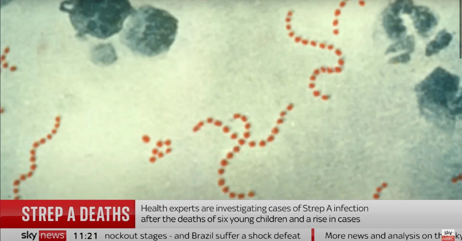 Strep A bacteria zoomed in