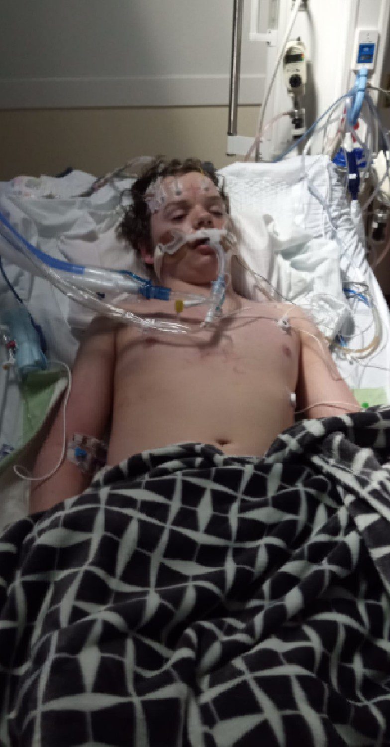 Jacob Stevens, who took on TikTok challenge, in hospital