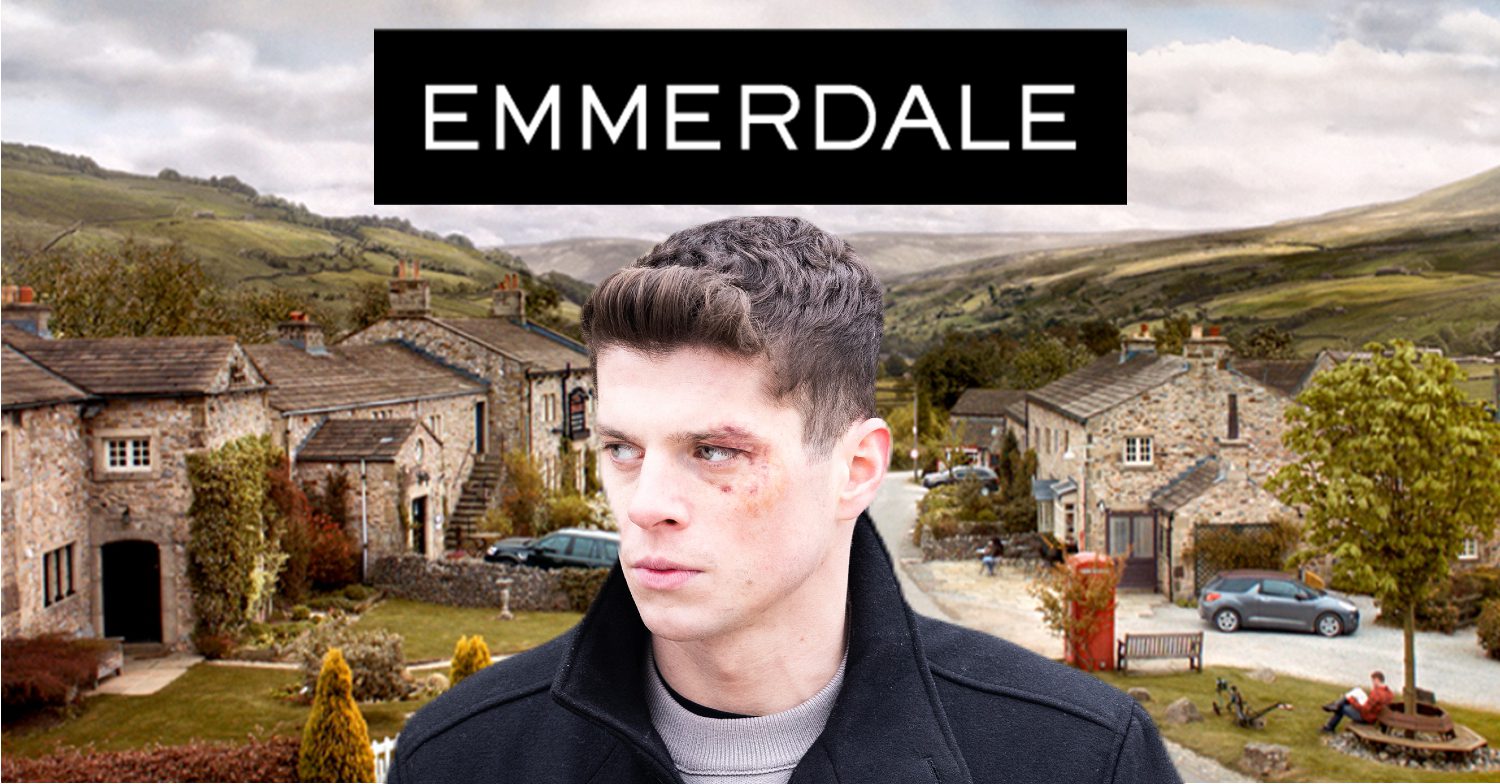 Emmerdale's Nicky is with the Emmerdale logo and background of the Dales
