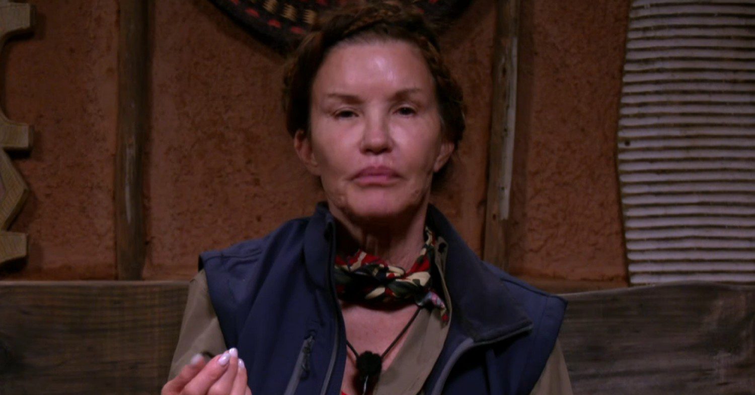 Janice Dickinson on I'm A Celebrity South Africa 