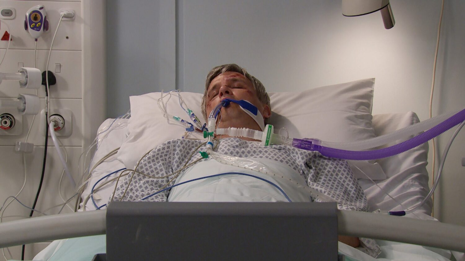Emmerdale spoilers: Caleb hooked up to machines in hospital