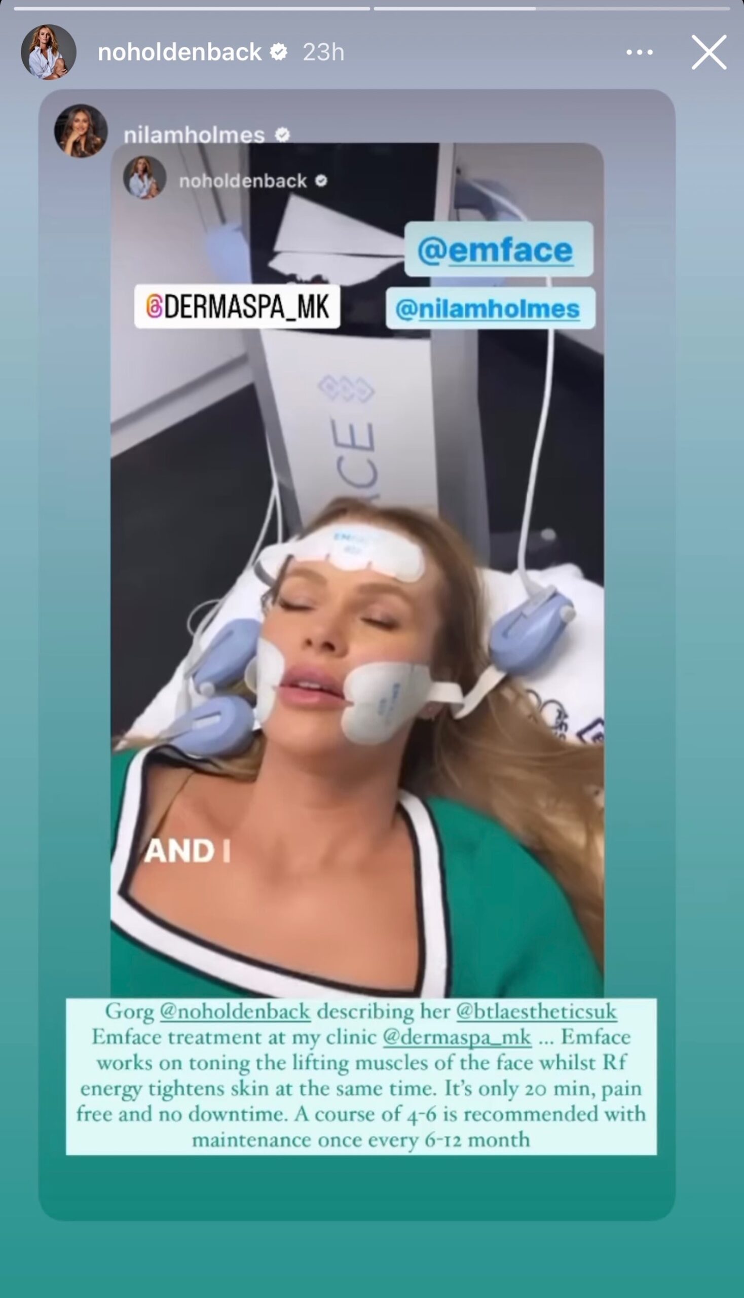 Amanda Holden on her Instagram Story 