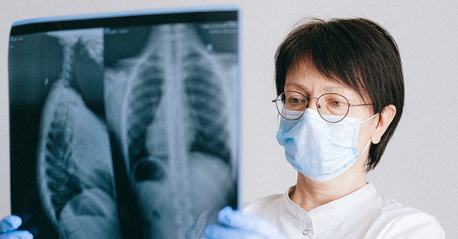 Doctor looks at lung scans