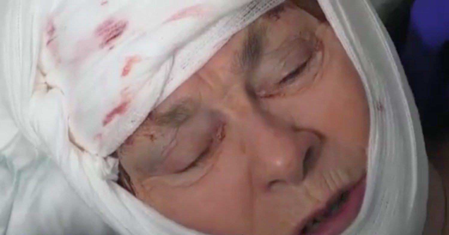 Joan appears on 24 Hours in A&E after falling on a moving tram