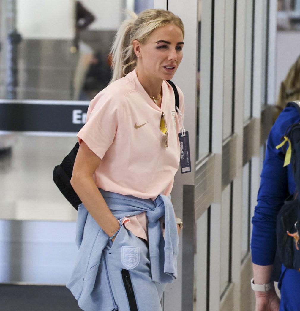 Lionesses star Alex Greenwood pictured at the airport with a black eye