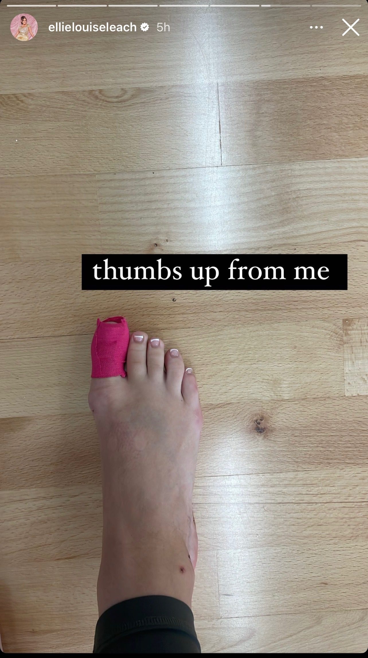 Strictly 2023 star Ellie's toe