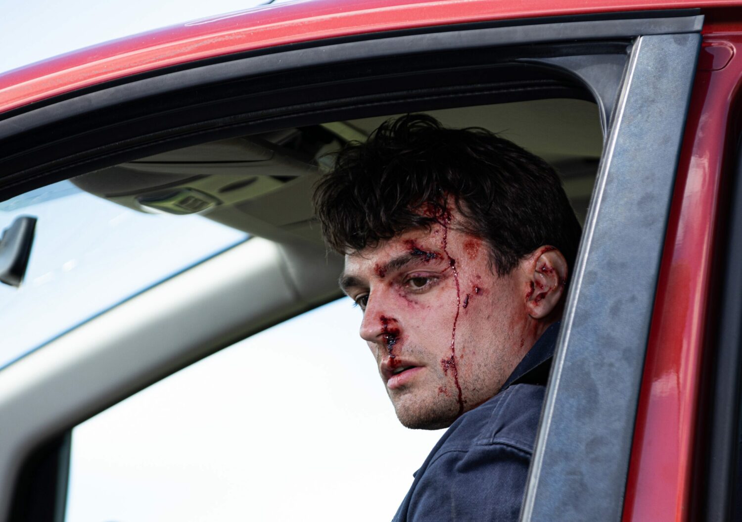 Bloodied and bruised Mack looks shellshocked after the car crash