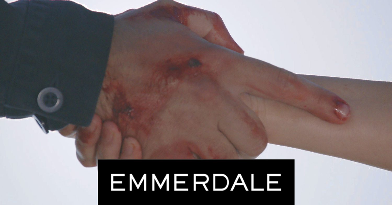 Emmerdale's Mack is holding a hand, the Emmerdale logo