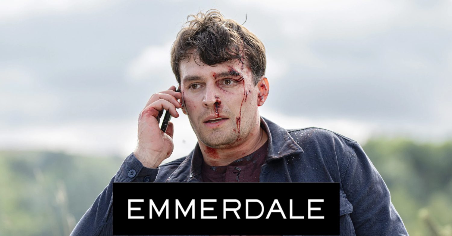 Emmerdale's Mack has cuts on his face whilst on the phone, the Emmerdale logo