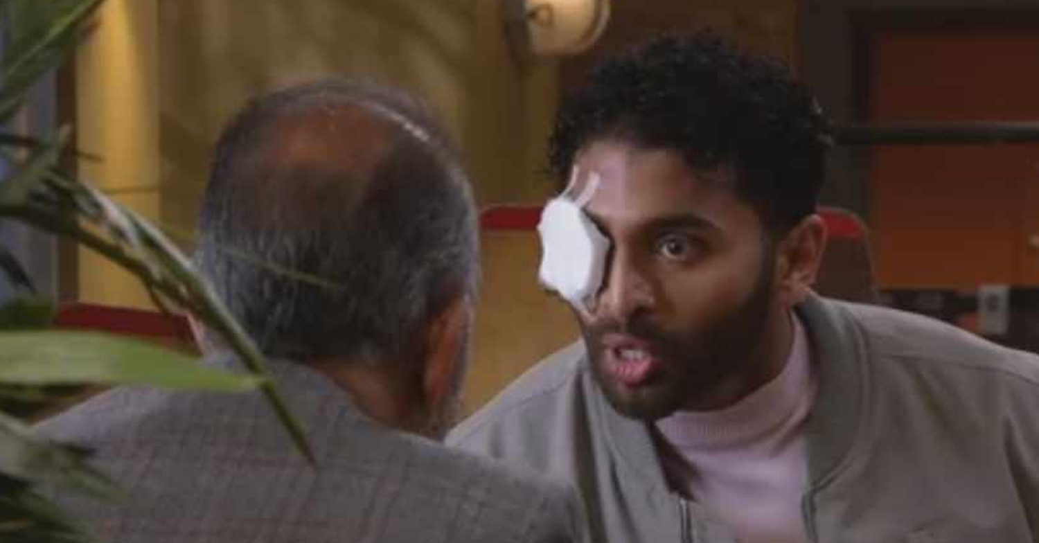 Emmerdale's Suni is wearing an eye patch