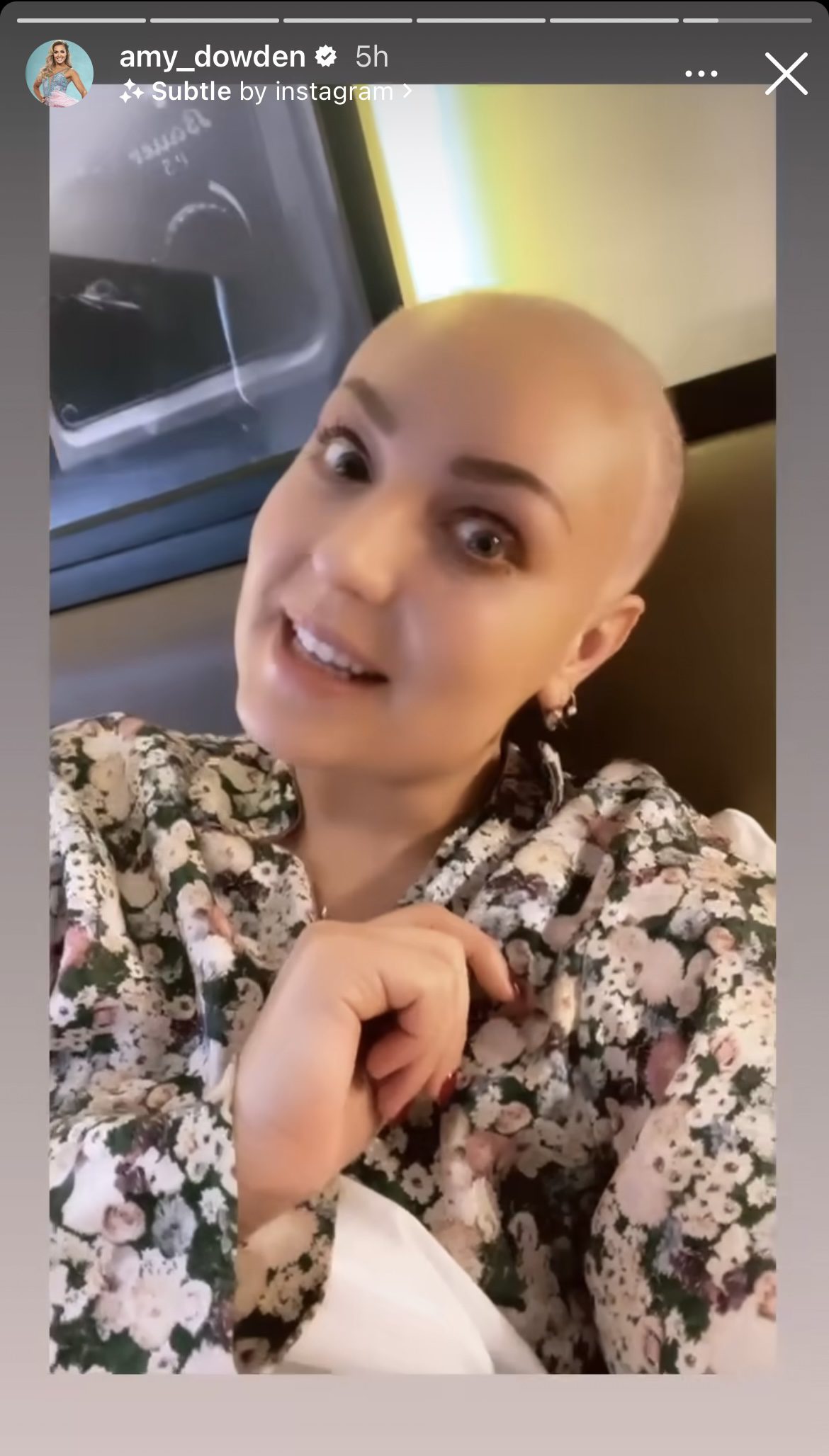 Amy Dowden talking on her Instagram Story