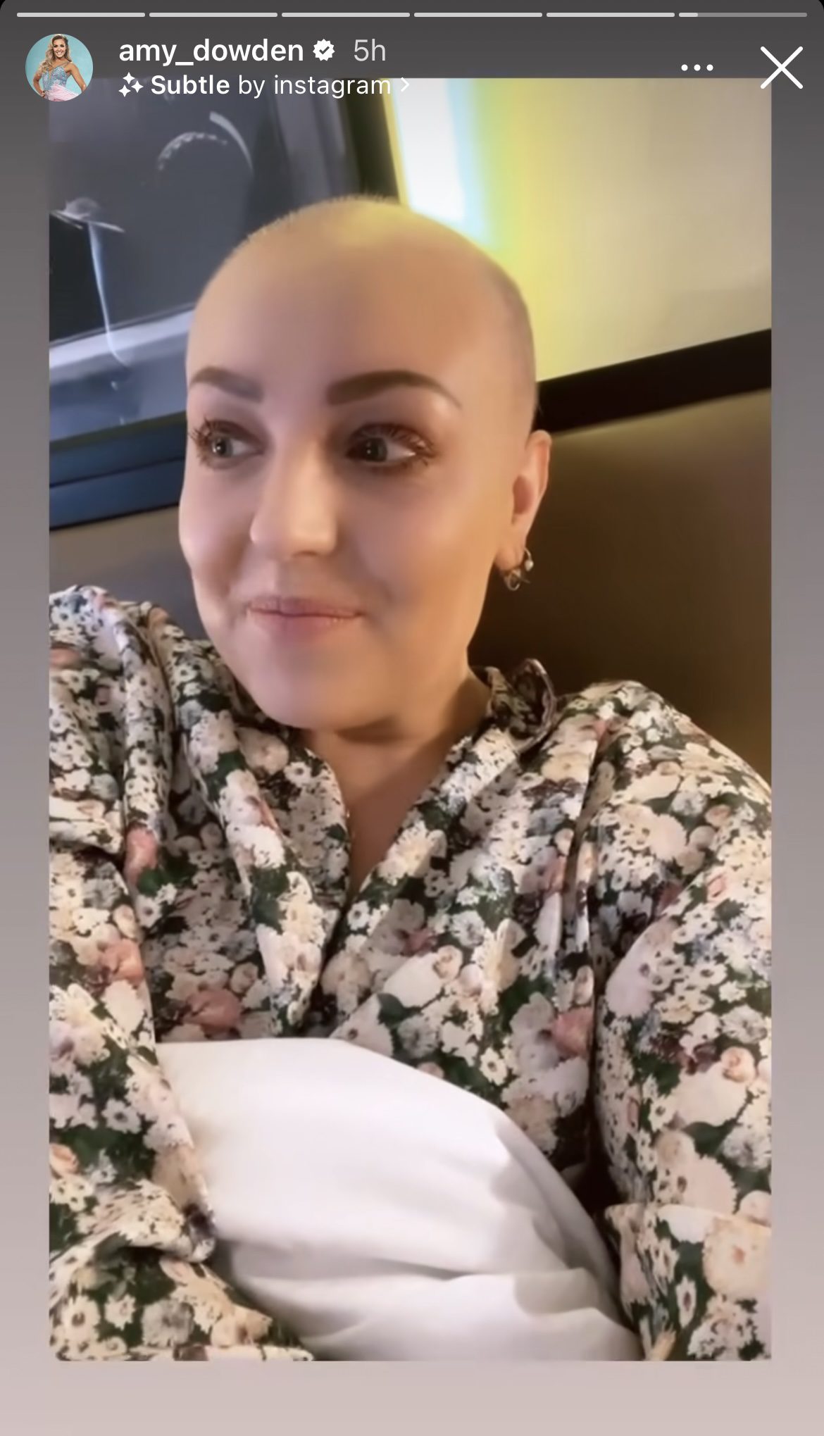 Amy Dowden talking on her Instagram Story