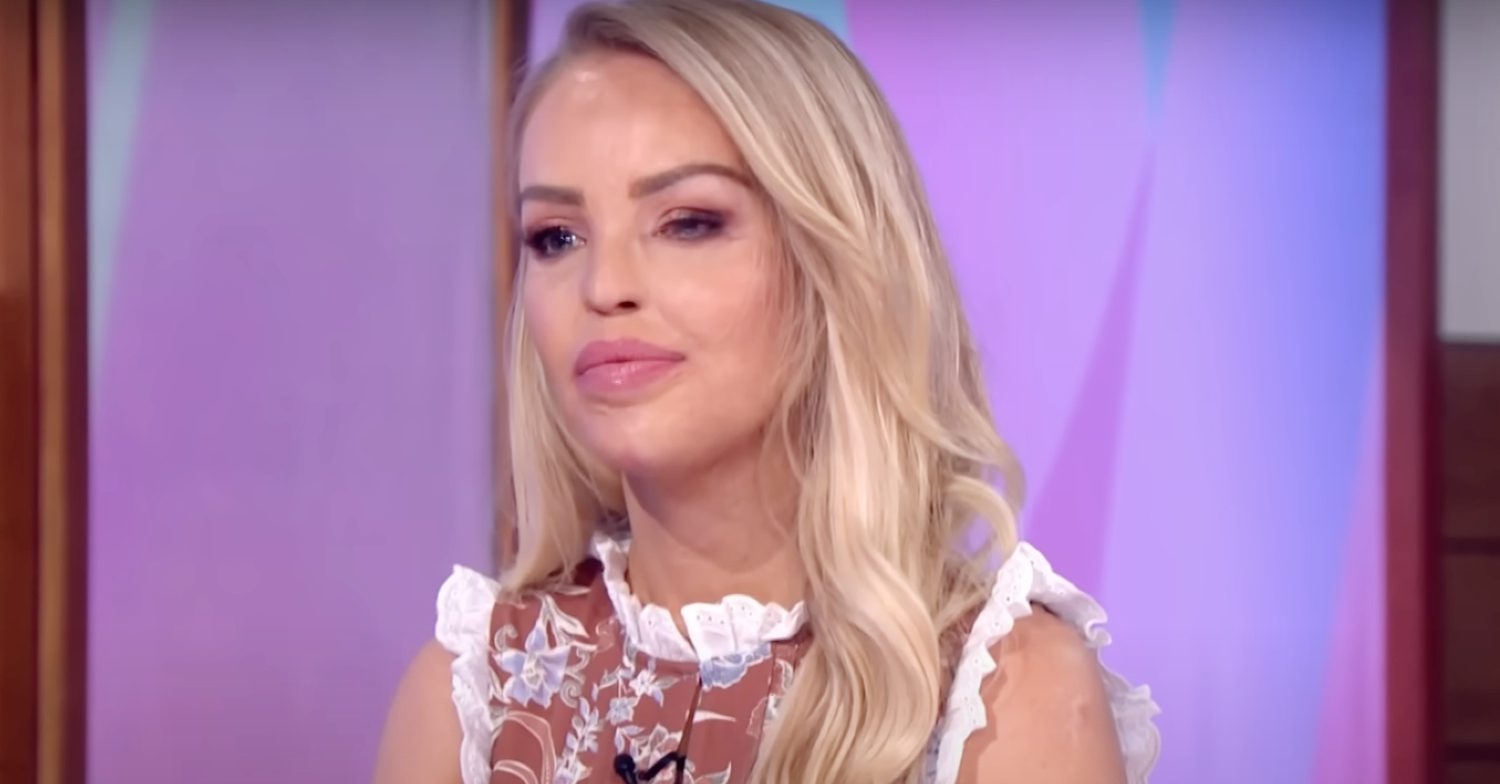 Katie Piper talks about her childhood