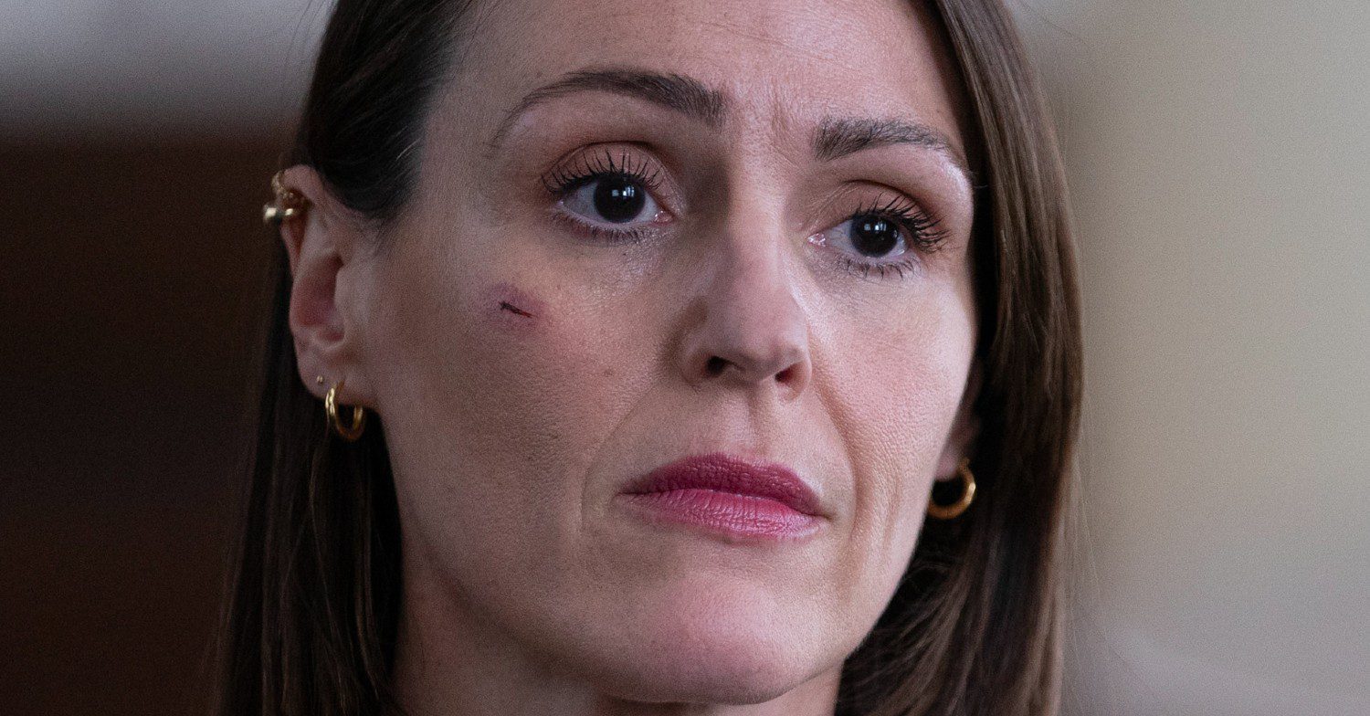 Suranne Jones with cut on her face as Amy Silva in Vigil series 2