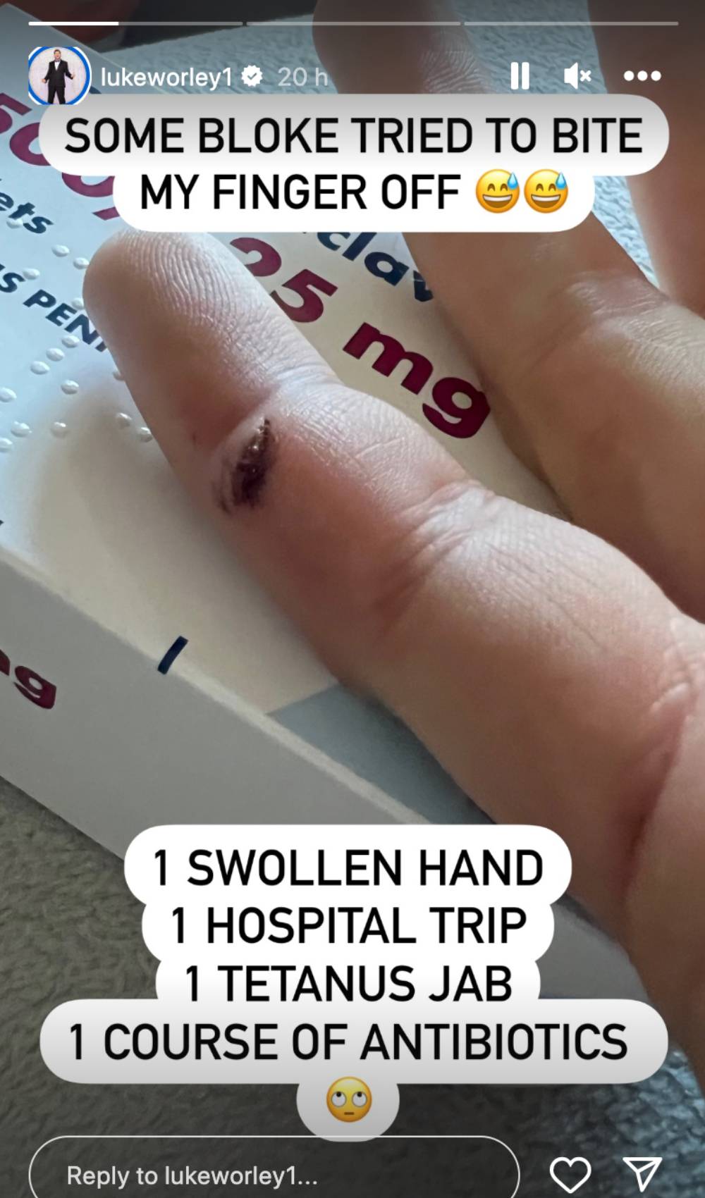 MAFS contestant Luke shares an Instagram Story