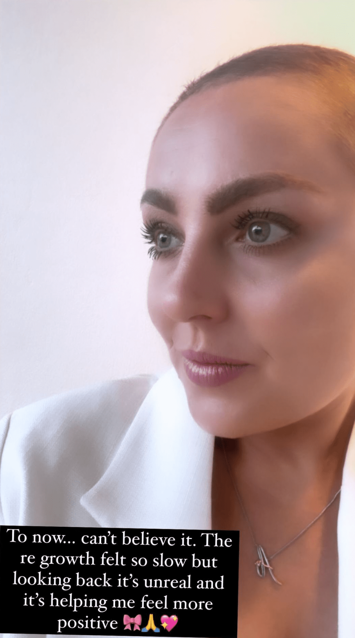 Close up of Strictly star Amy Dowden