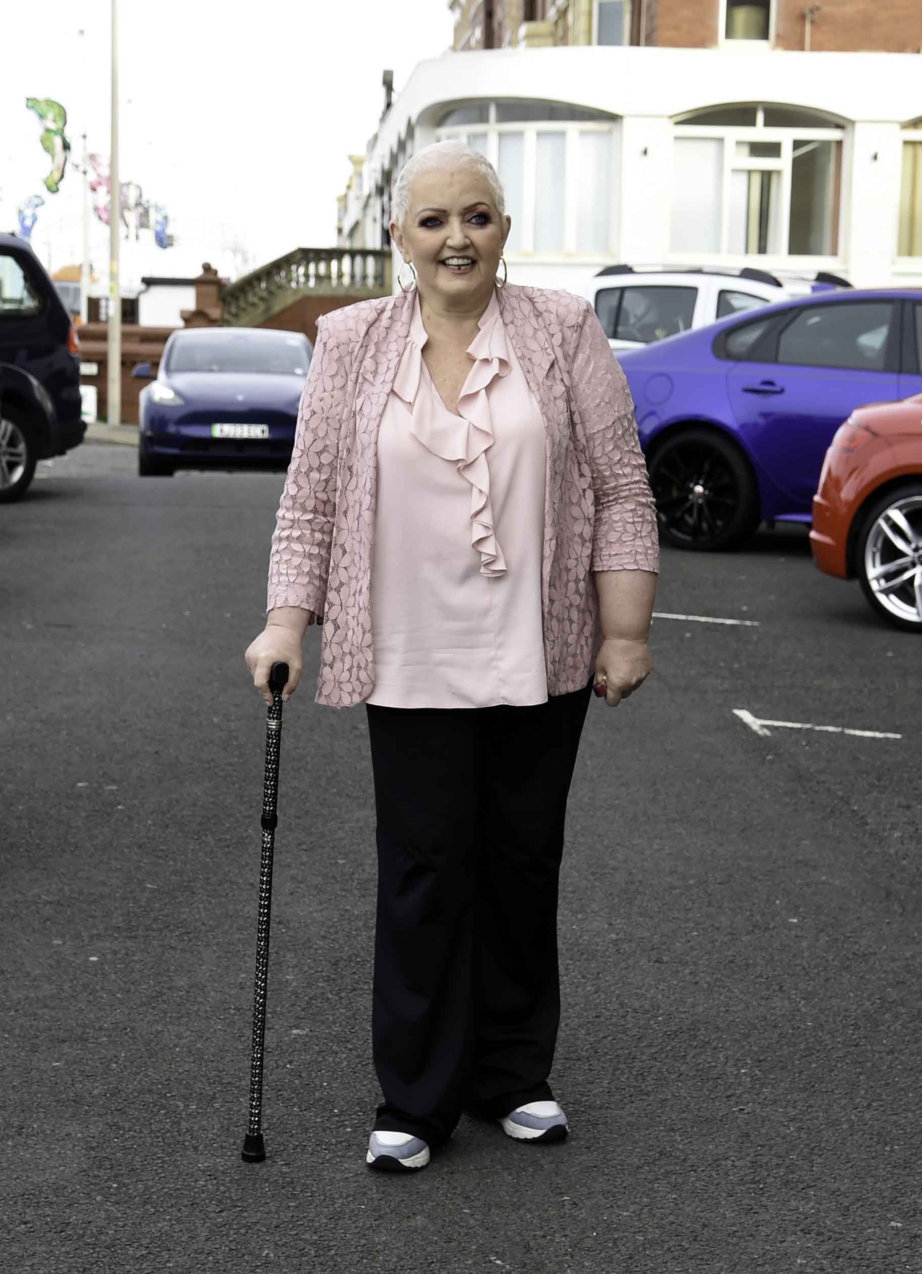 Linda Nolan in a pink top walking with a stick