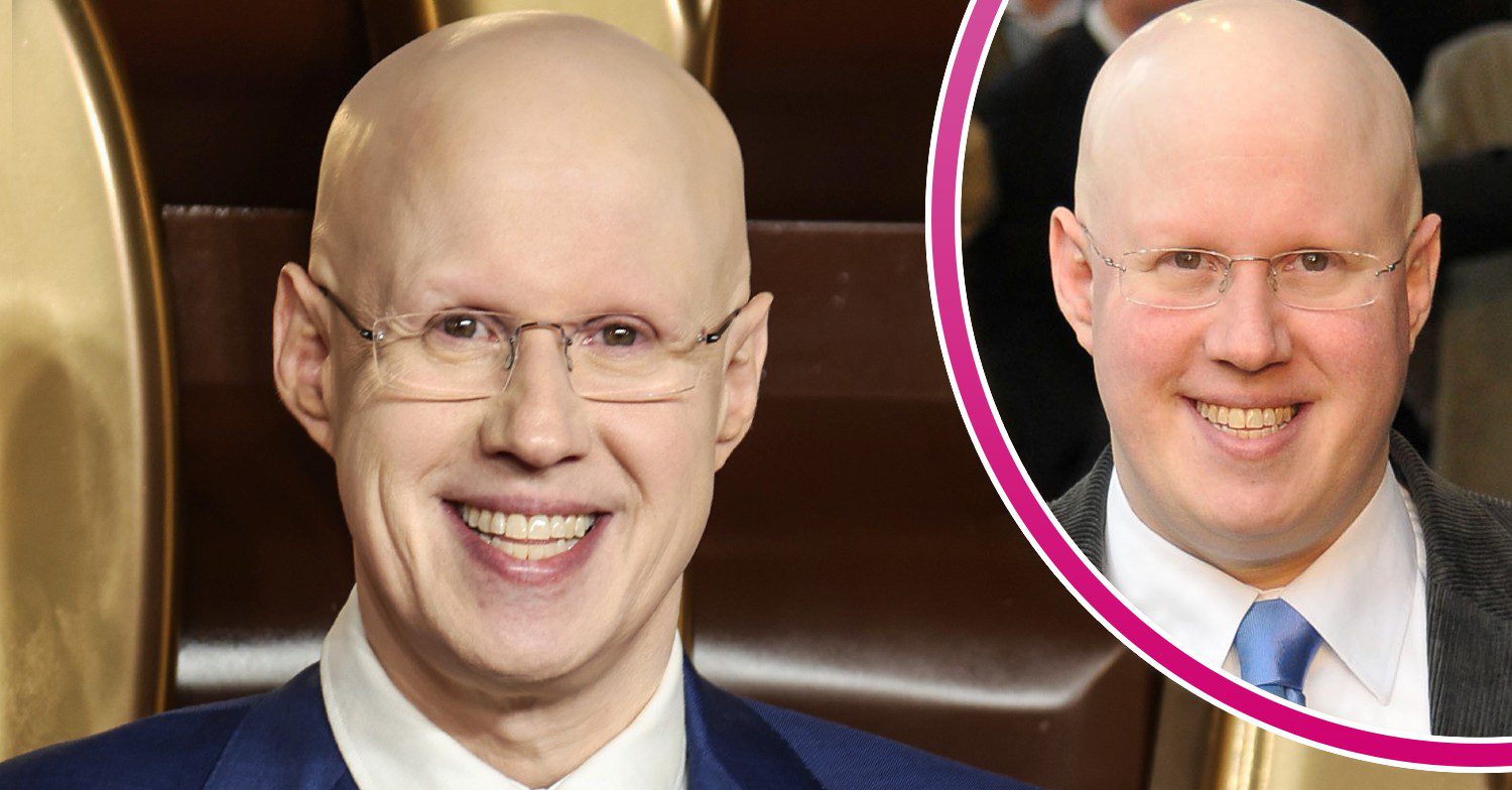 Matt Lucas smiling in before and after pics of weight loss