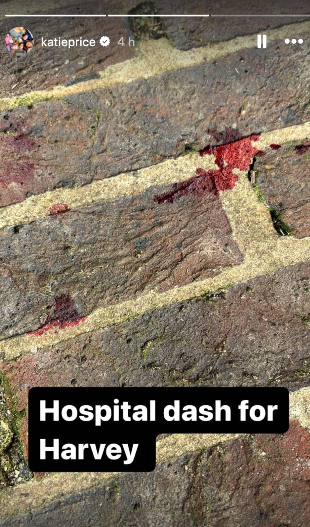 Katie Price Instagram Story showing drip of blood