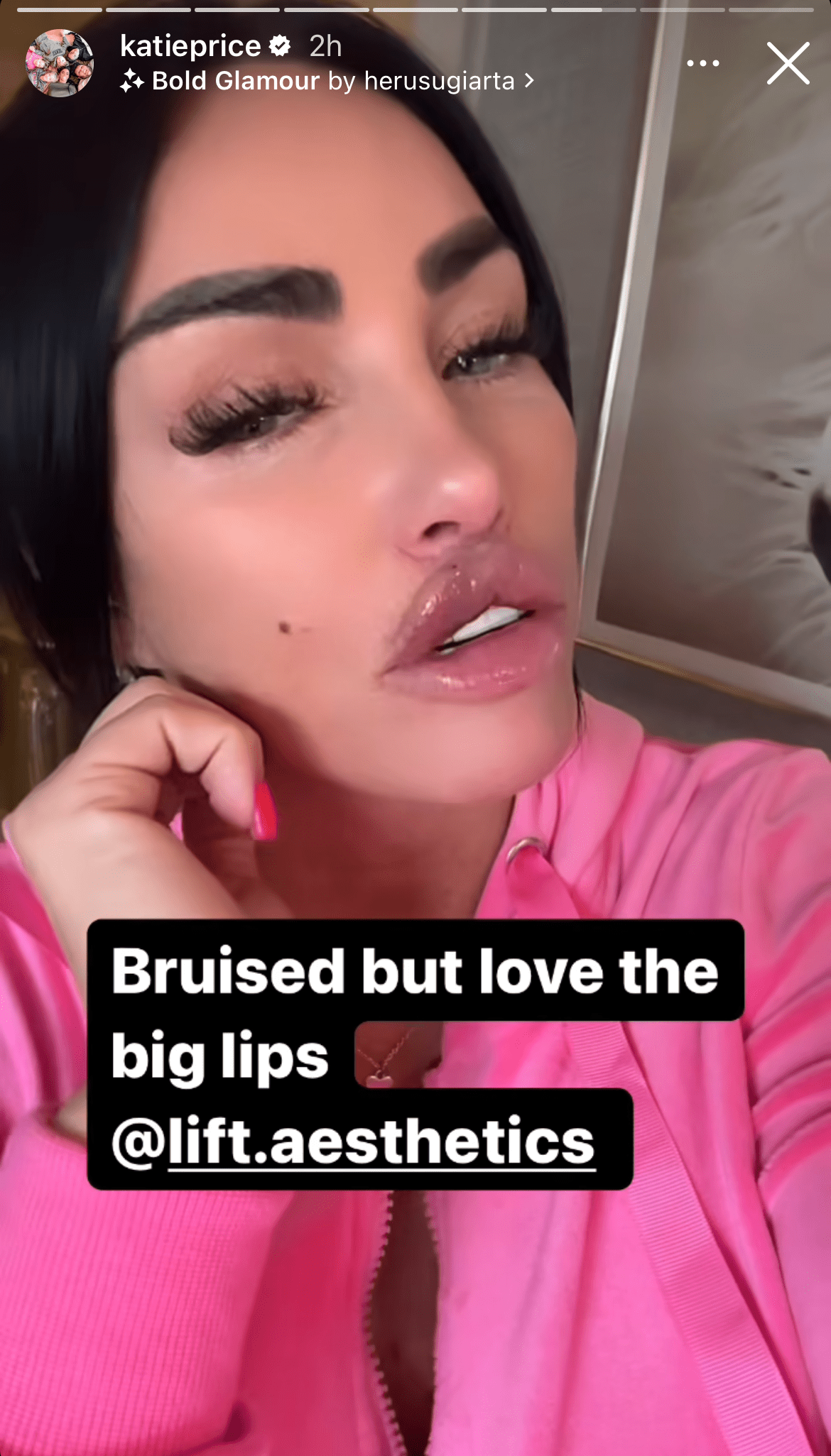 Katie Price on her Instagram Story