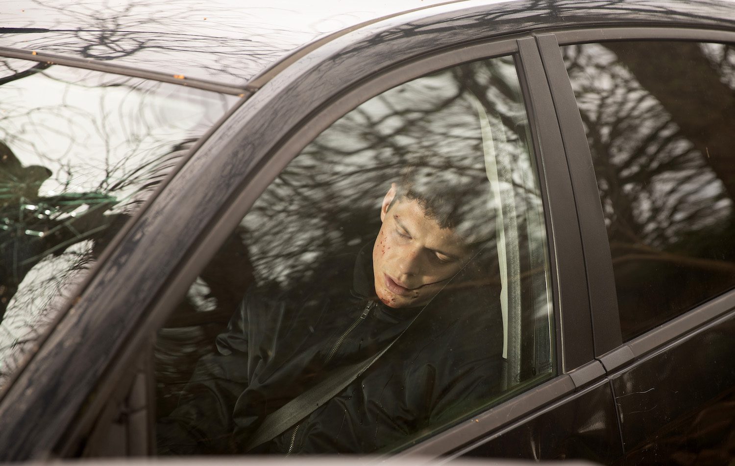 Nicky Miligan is unconscious in the car after the crash with cuts to his face