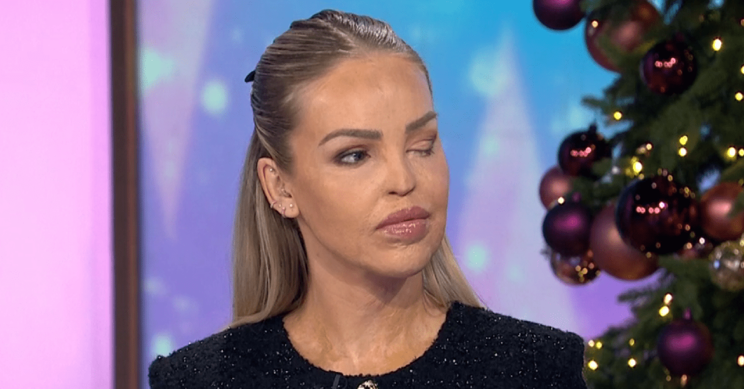 Katie Piper on Loose Women looking straight faced