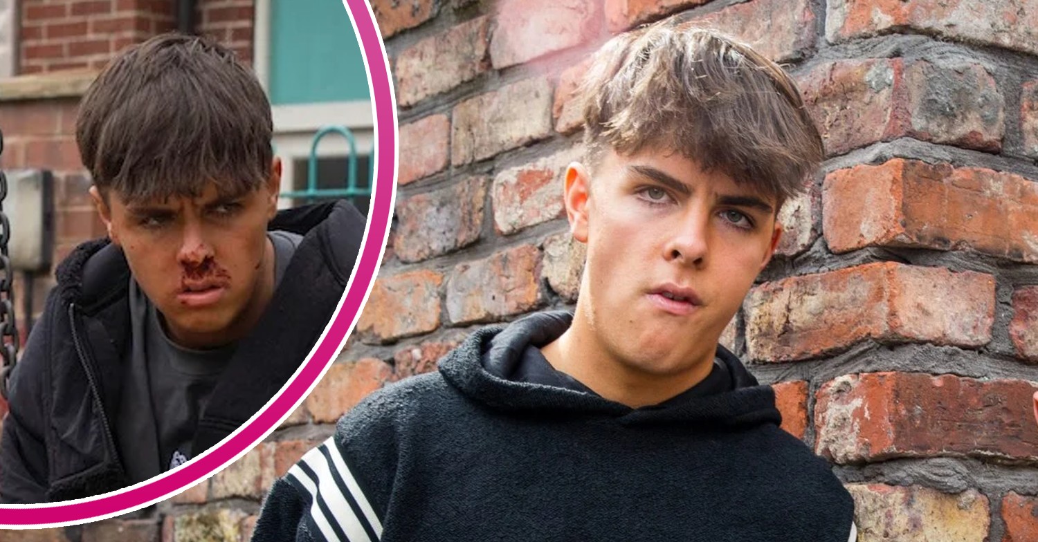 Mason looking menacing on Corrie; inset, battered and bruised (Credit: ITV/Composite: ED!)