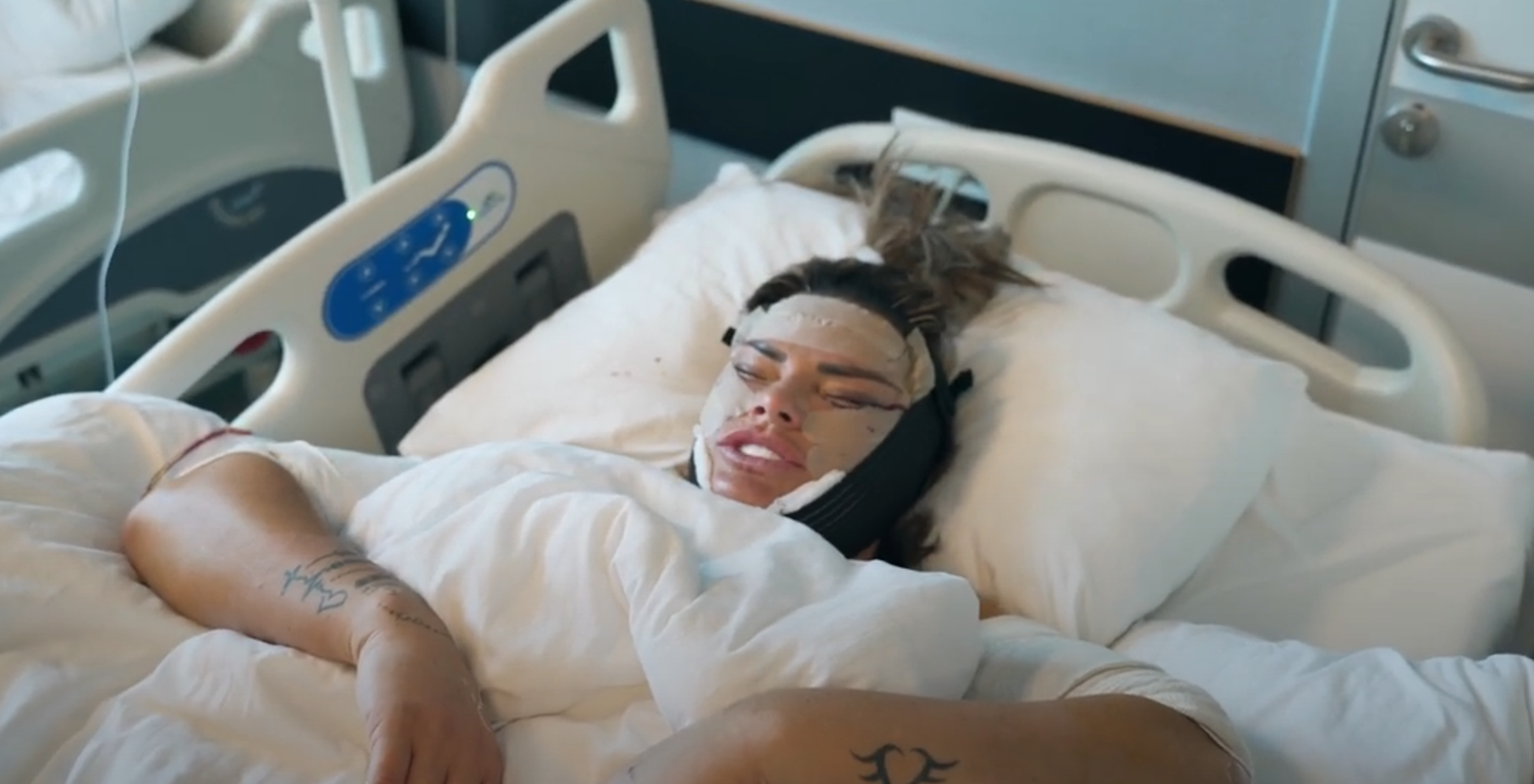 Katie Price facelift