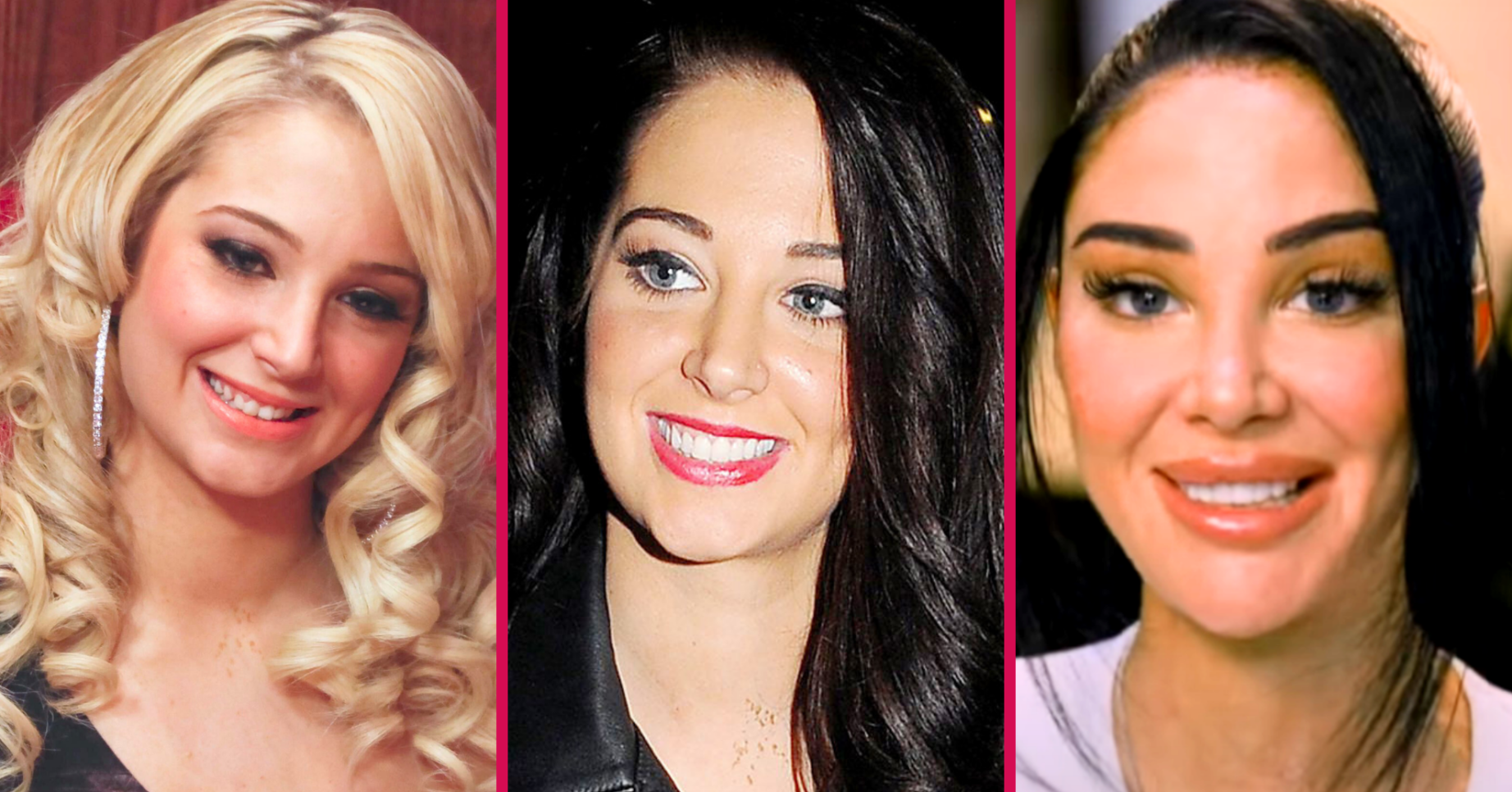 Split image showing Tulisa before and after her smile makeover