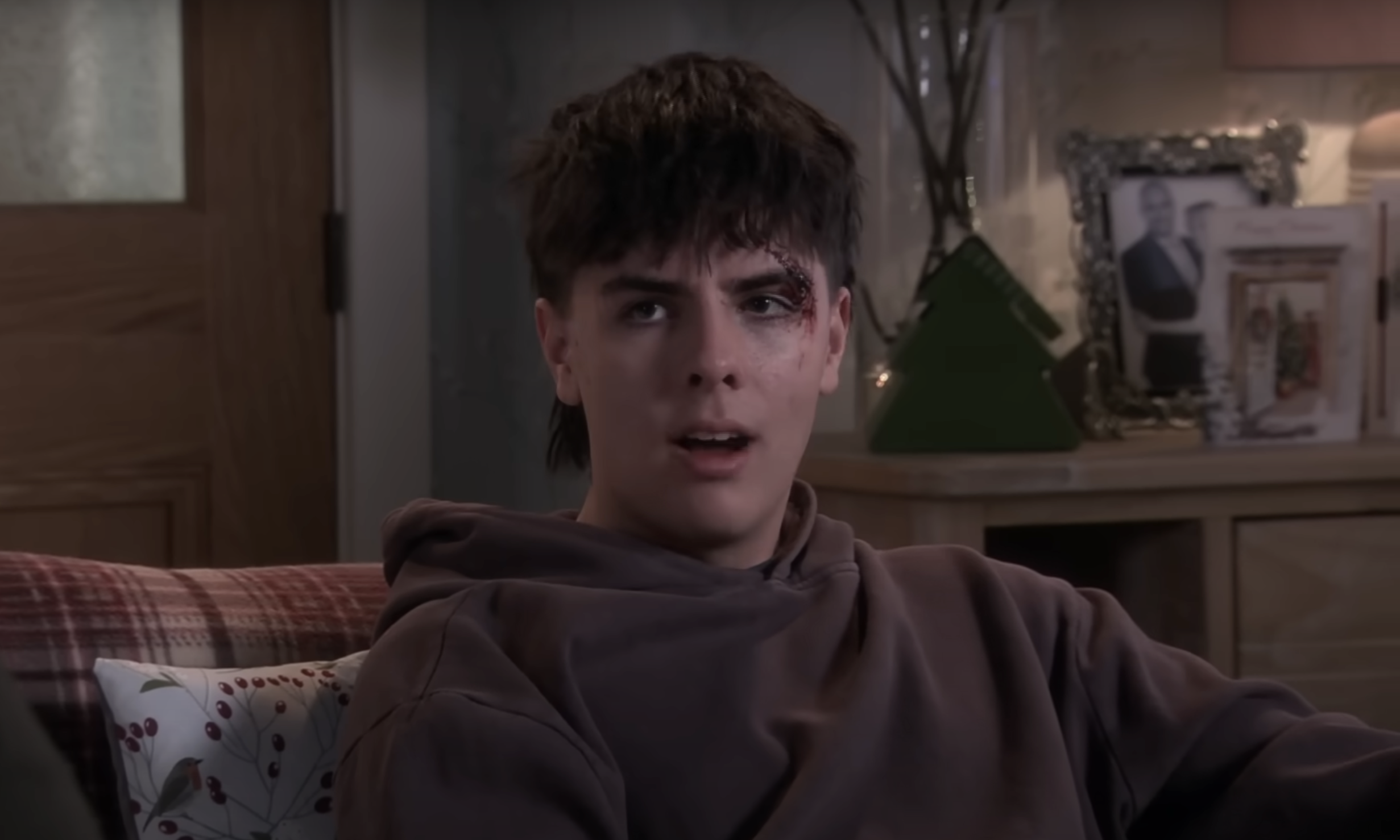 Coronation Street: Mason with a cut on his head 