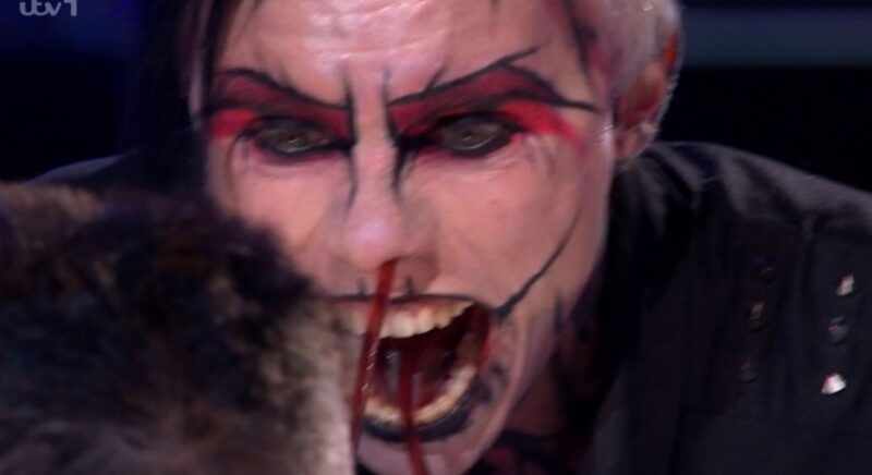 Auzy Blood with tube through his nose on BGT