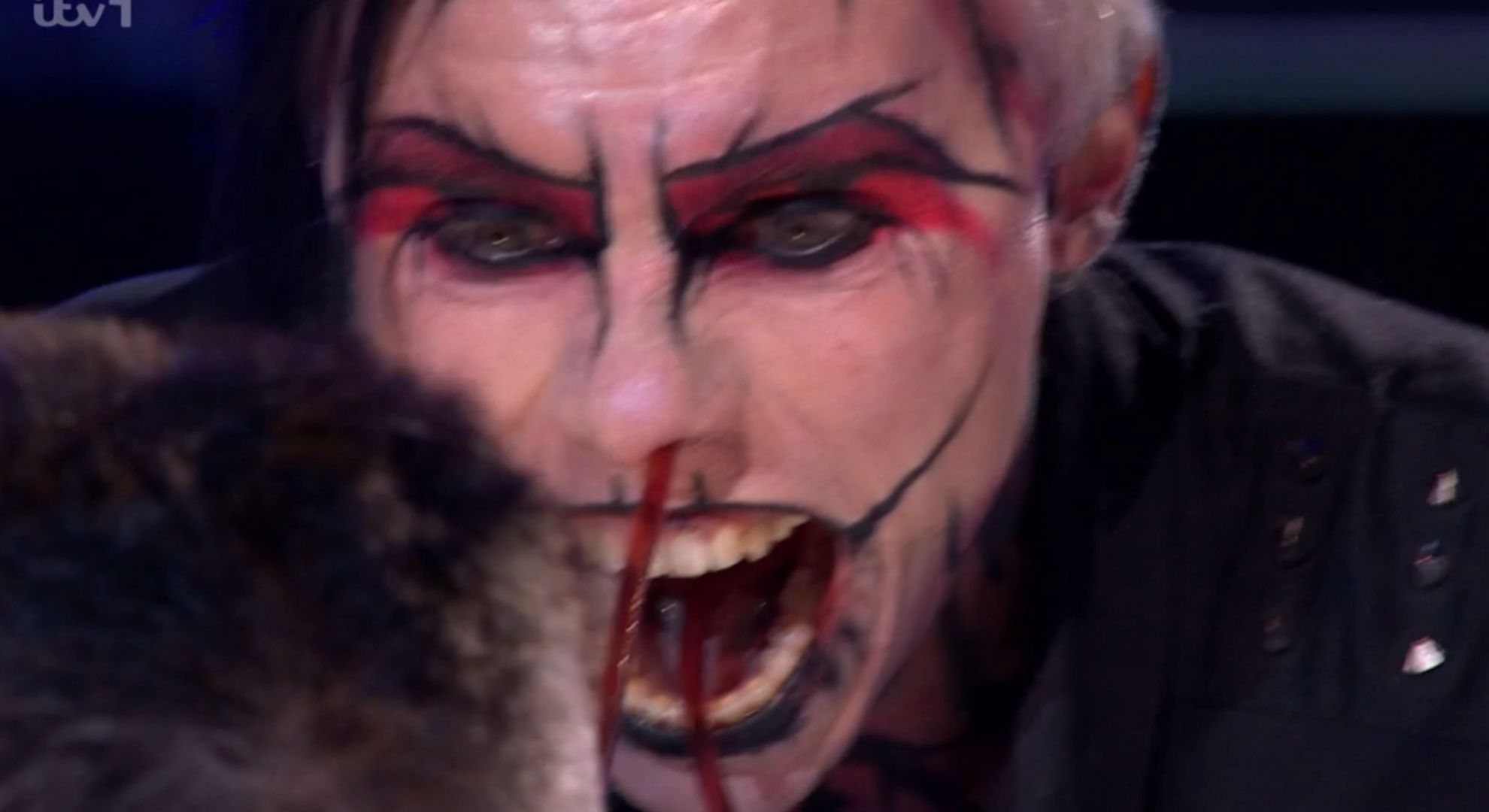 Auzy Blood with tube through his nose on BGT