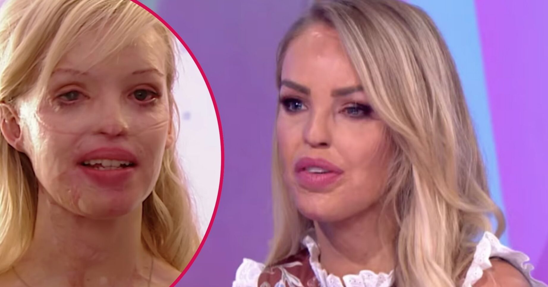 Katie Piper on Loose Women