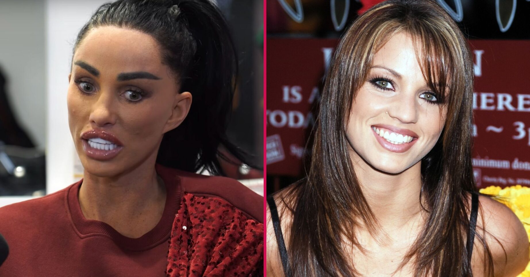 Katie Price before and after