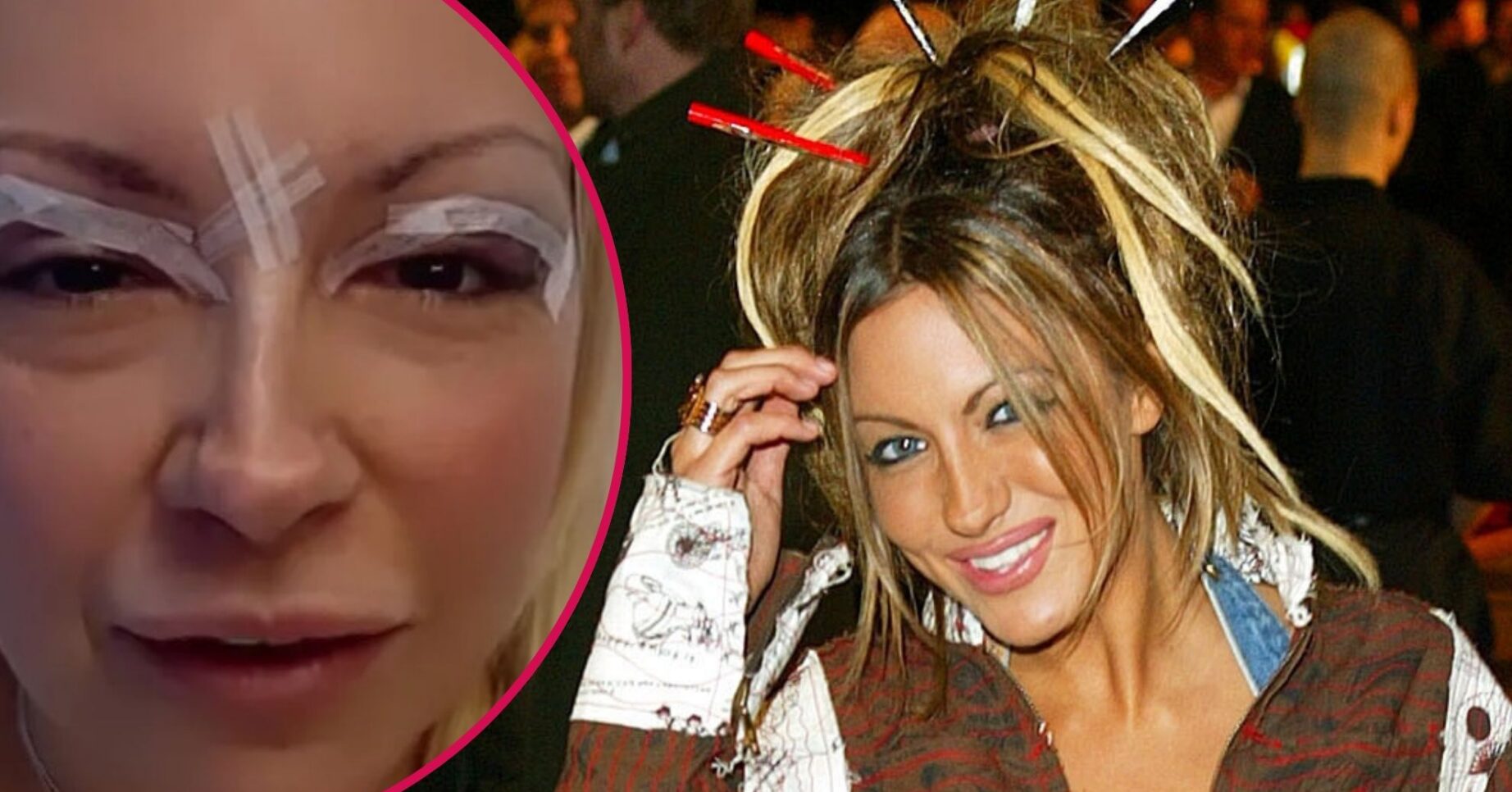 Jodie Marsh smiling / Jodie Marsh after surgery