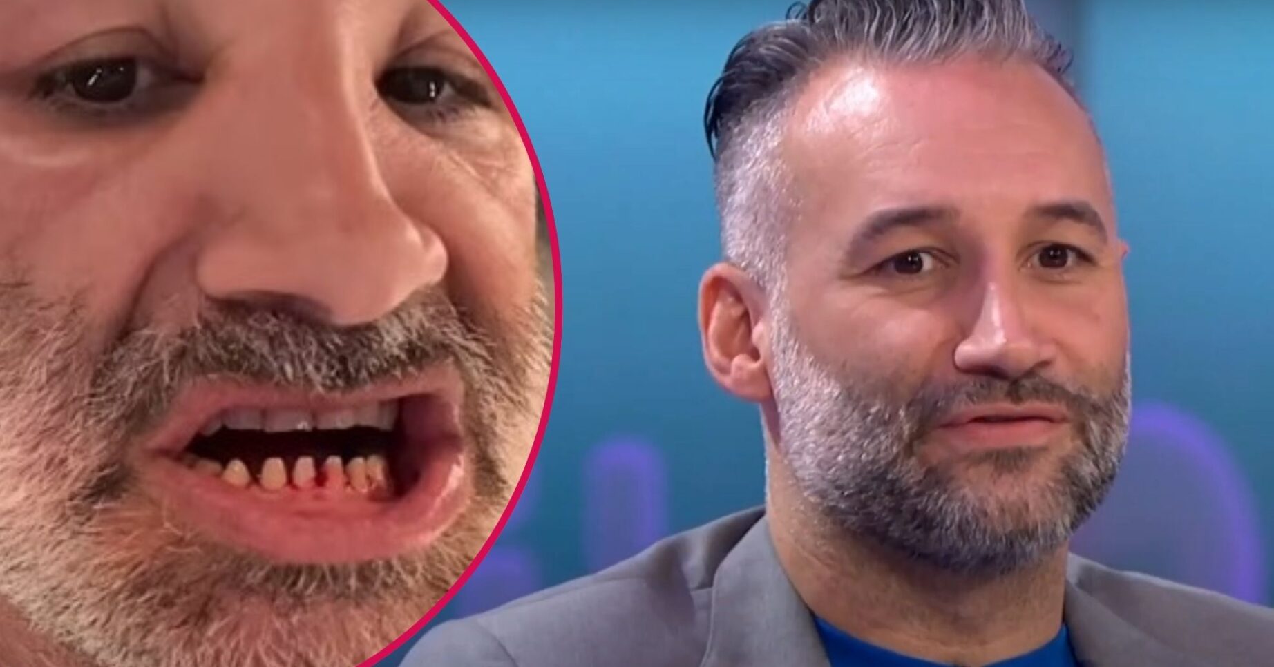 Dane Bowers on GMB/Dane Bowers showing off teeth