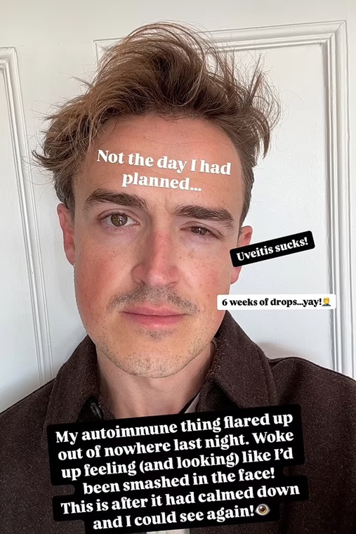 Tom Fletcher Instagram Story