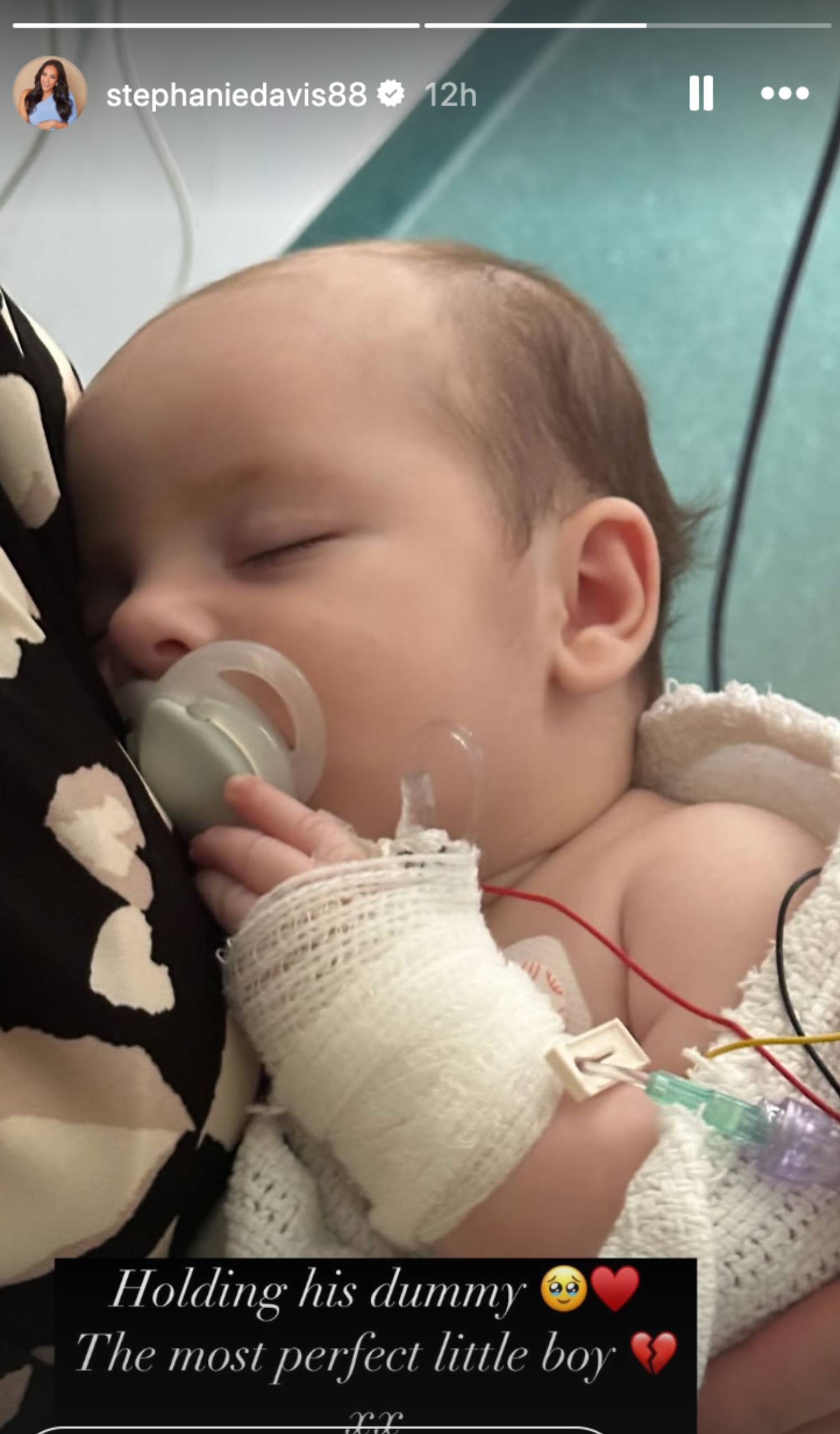 Stephanie Davis shares baby Story pic