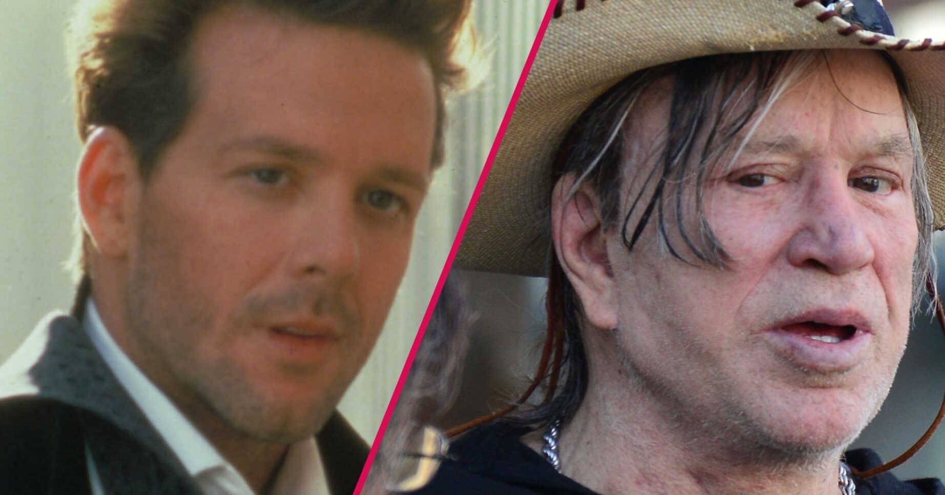 Mickey Rourke before and after surgery
