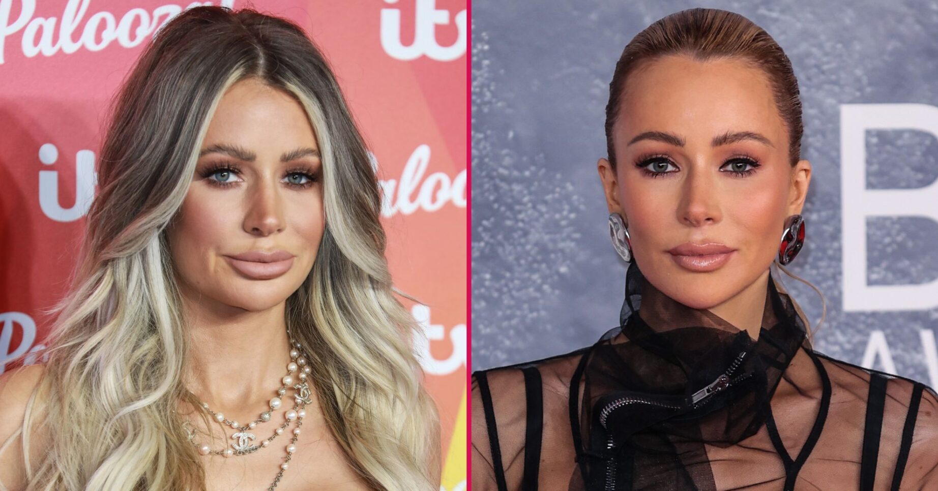 Olivia Attwood before and after