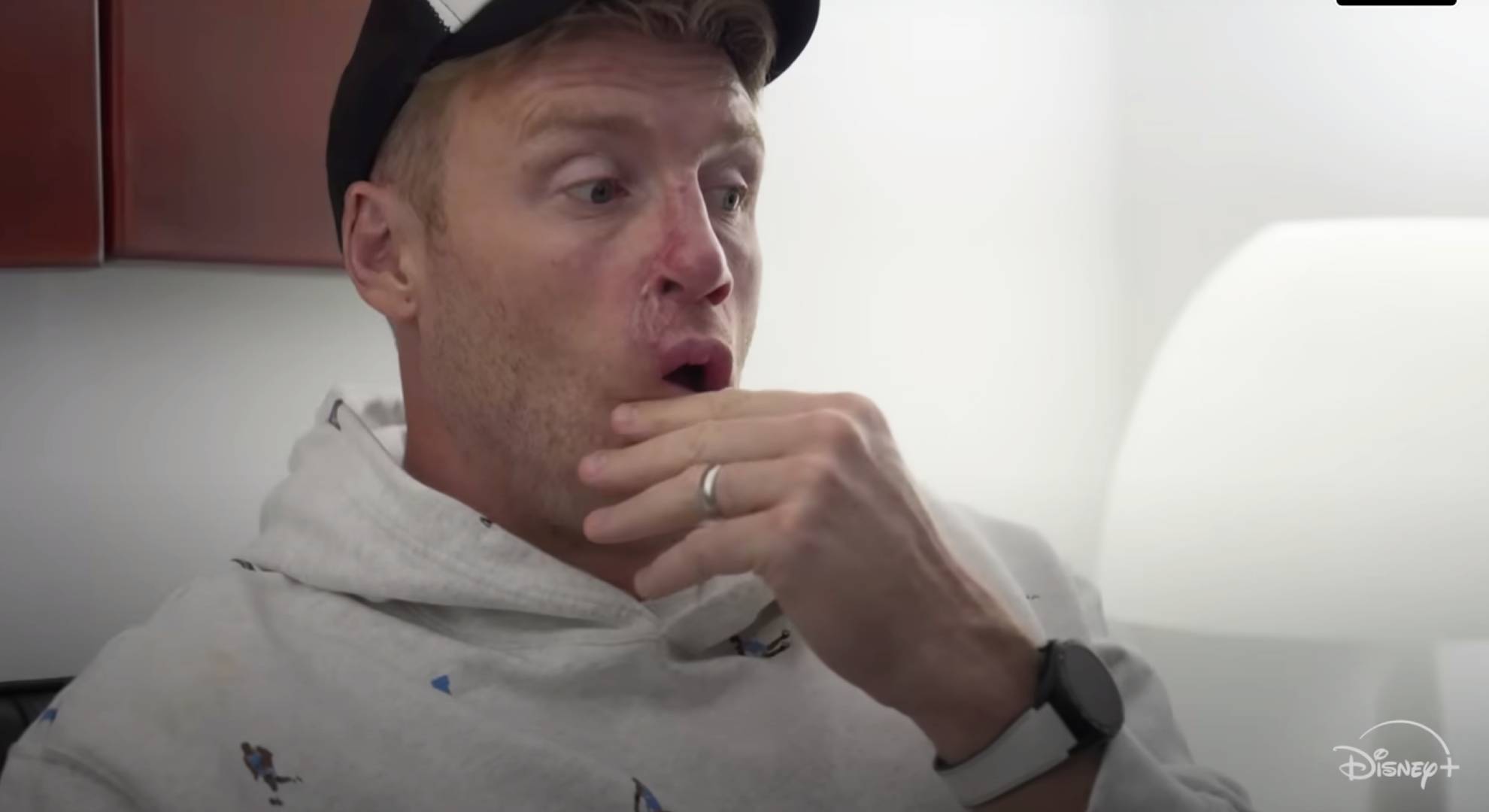 Freddie Flintoff rubs his chin
