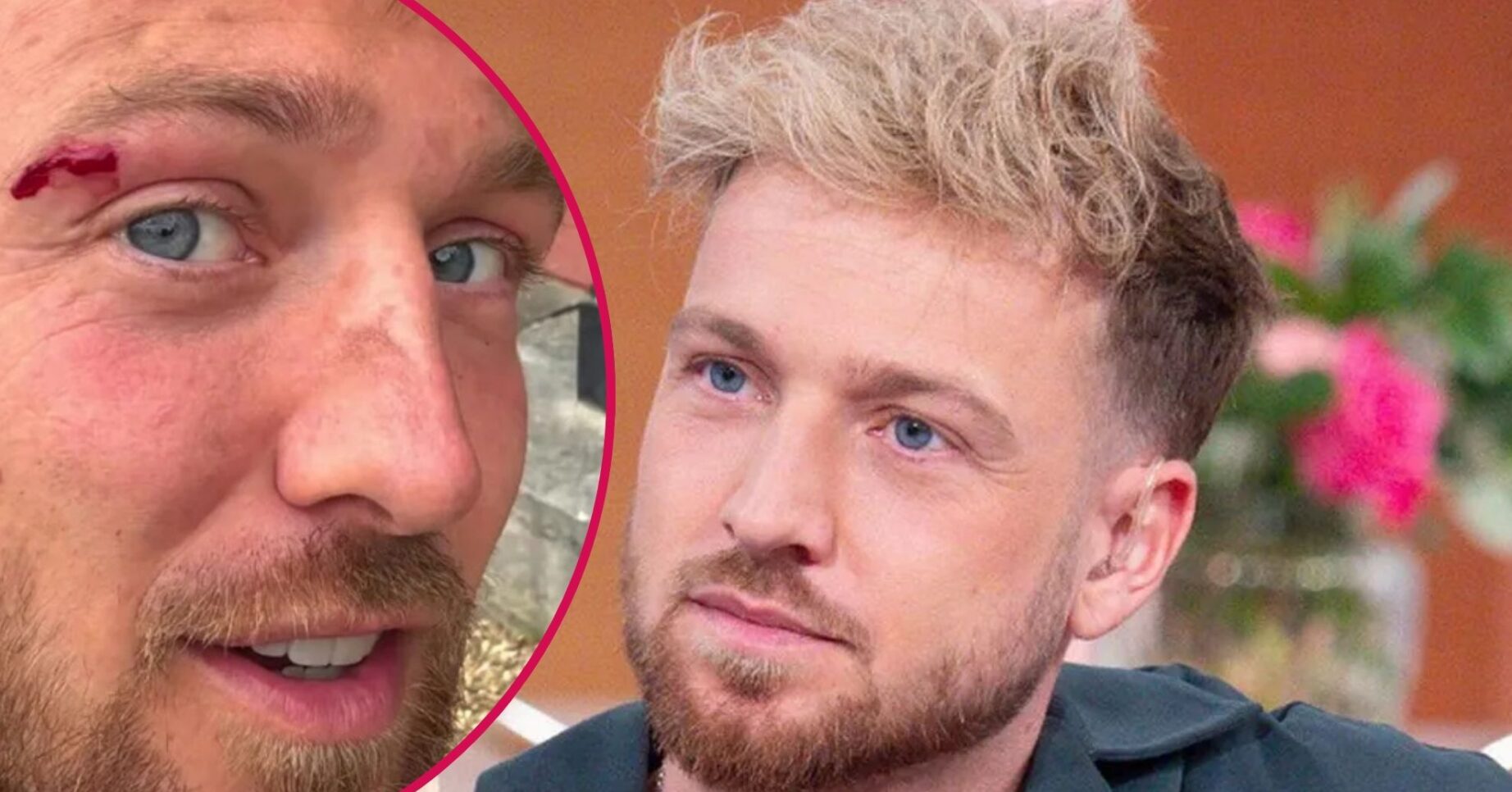 Sam Thompson bloody face / Sam Thompson on This Morning