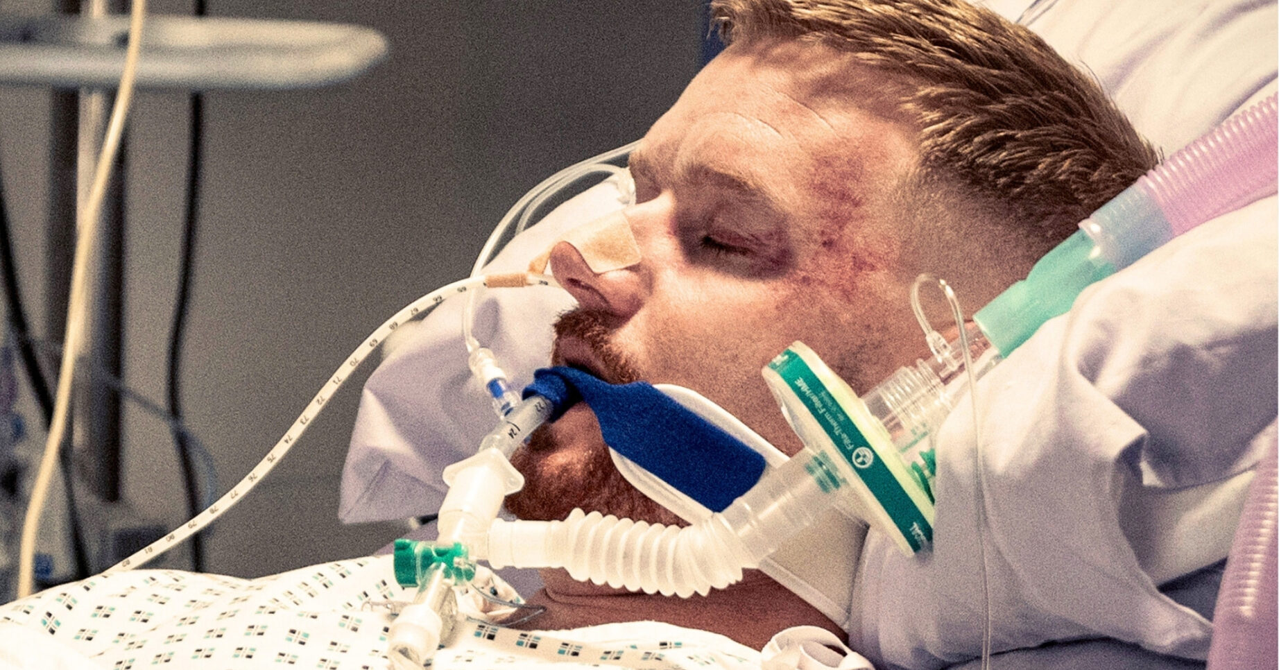 Coronation Street's Gary in a coma